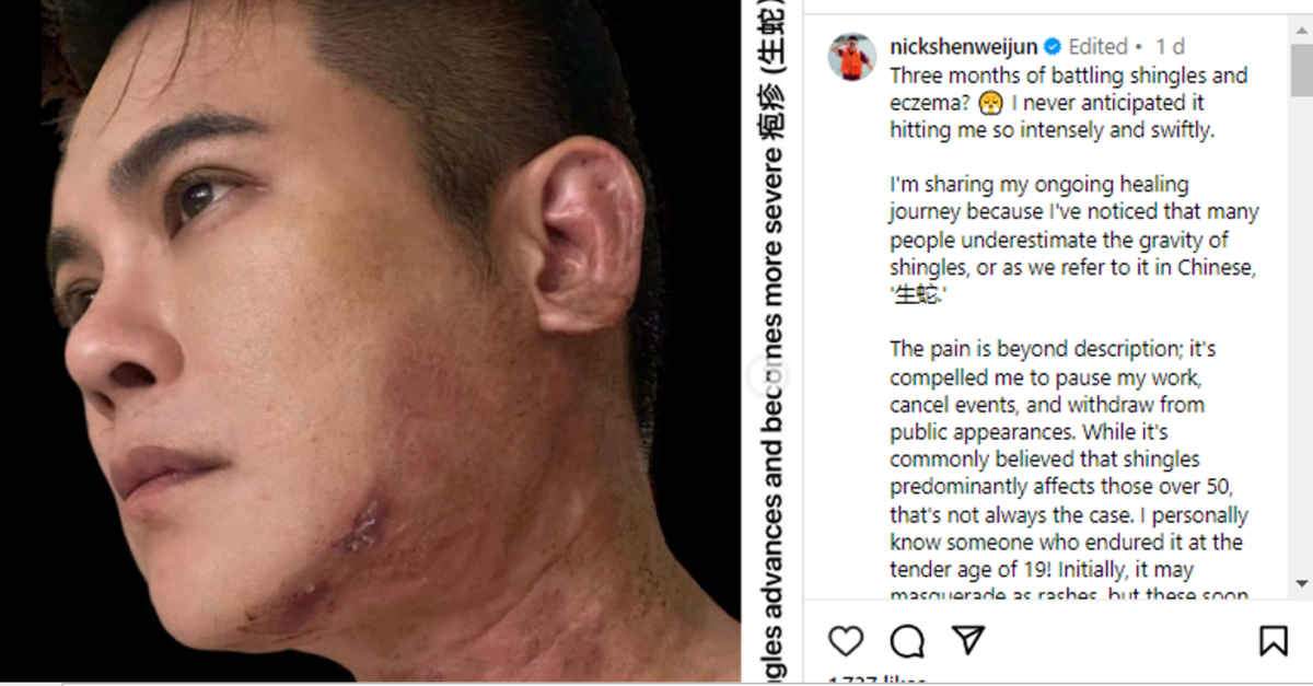 Former Mediacorp Actor Nick Shen Opens Up About His Battle Against Shingles That Caused Paralysis in Half of His Face